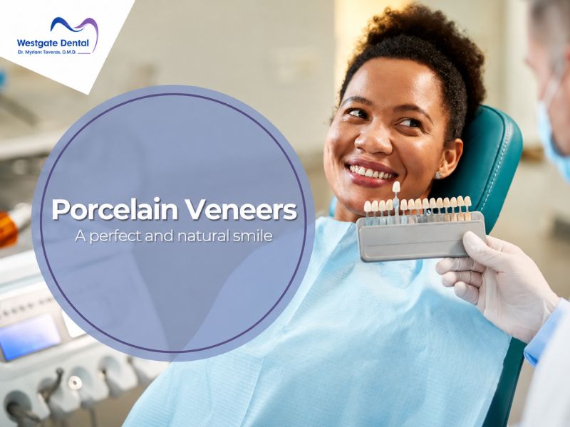 Veneers